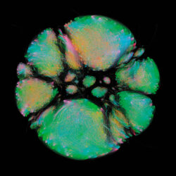 Microbiome Selfie, François-Joseph Lapointe, 2014